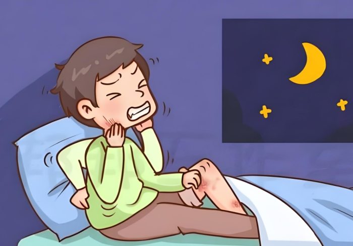 疥蟲治療 疥蟲治療